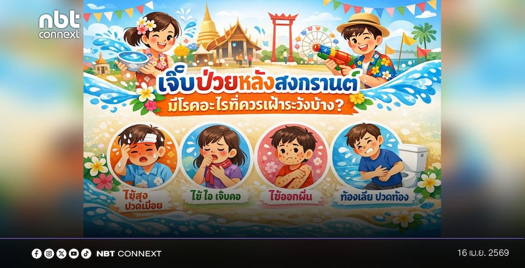 กรมควบคุมโรค เปิดอาการเฝ้าระวังหลังสงกรานต์ แนะประชาชนสังเกตตัวเอง-บุตรหลาน เพื่อลดความรุนแรงของโรค ลดโอกาสแพร่กระจายเชื้อ