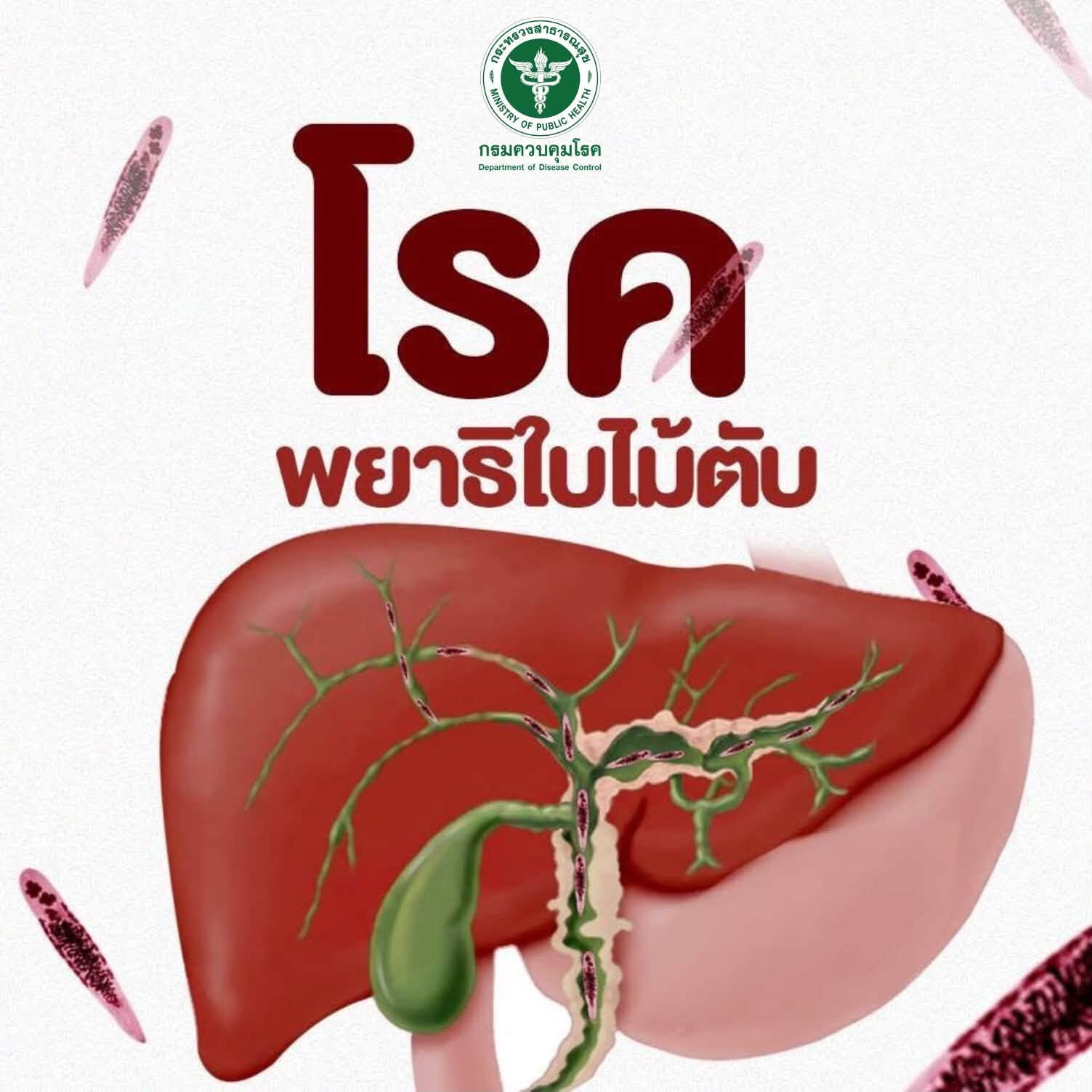 โรคพยาธิใบไม้ตับ