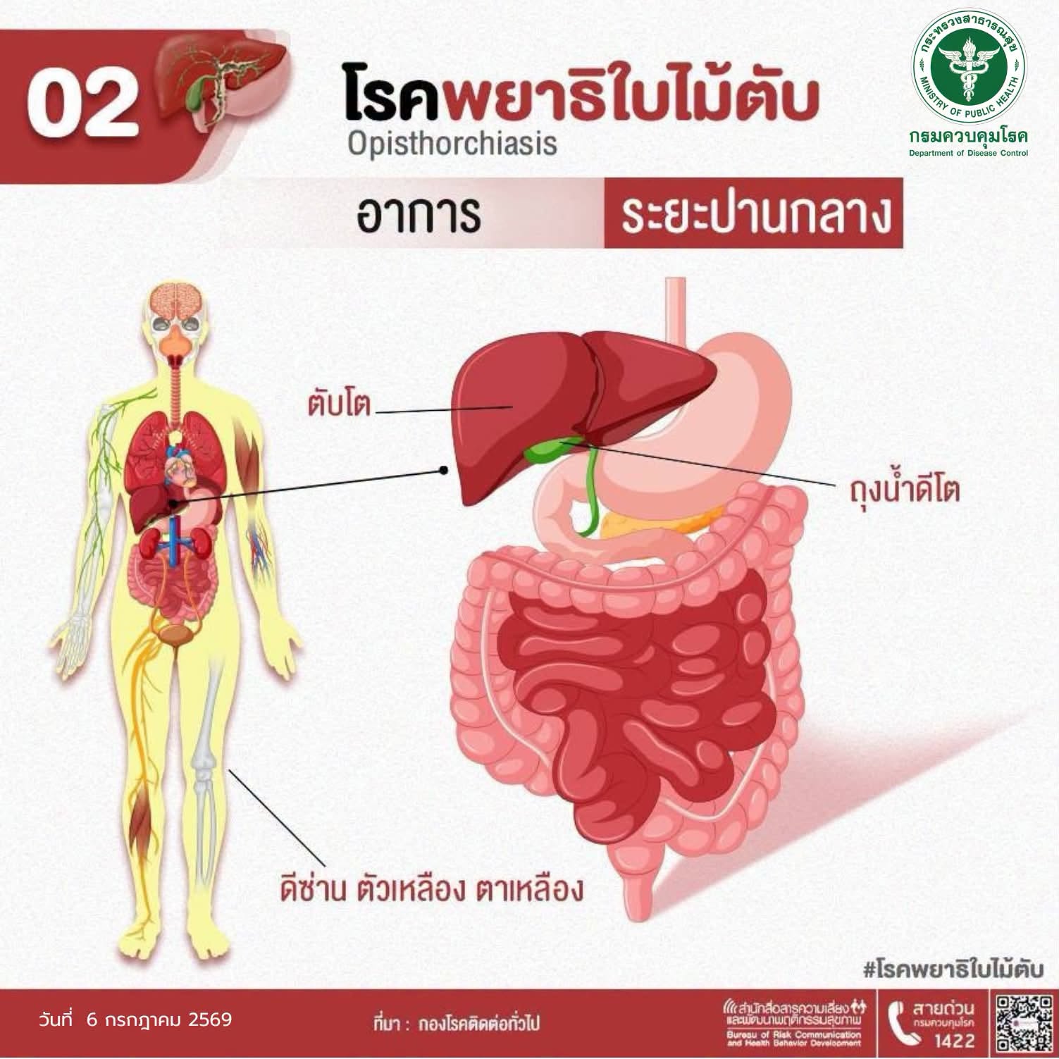 02 โรคพยาธิใบไม้ตับ