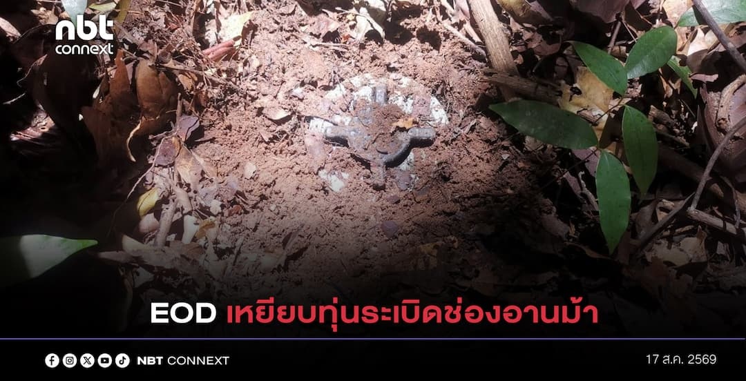 กองทัพภาคที่ 2 แจ้ง กำลังพลเหยียบทุ่นระเบิดขณะปฏิบัติหน้าที่ ใกล้ช่องอานม้า ขาขวาท่อนล่างขาด